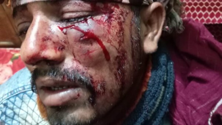 নোয়াখালীতে বিএনপির কার্যালয়ে আ.লীগের হামলা, আহত ৪