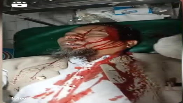 হাতিয়ায় প্রতিবাদী মিছিলের প্রস্তুতিকালে হামলার অভিযোগ, আহত ২